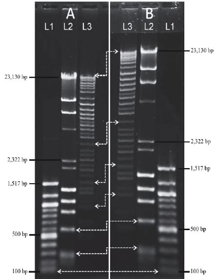 DNA migration in gel electrophoresis .